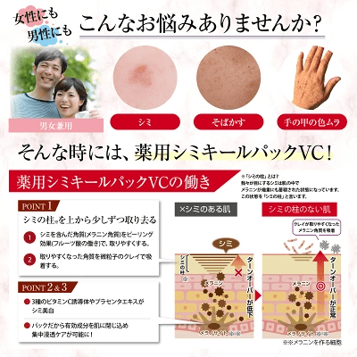 シミができやすい部位は?