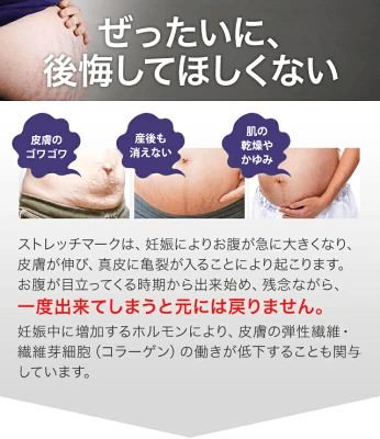 妊娠線は消える?