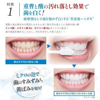 歯が黄ばむ理由