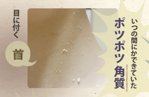 ぽろぽろとれる杏ジェル