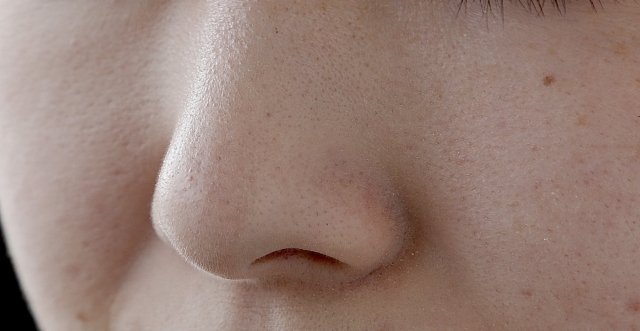 毛穴トラブルの原因とは