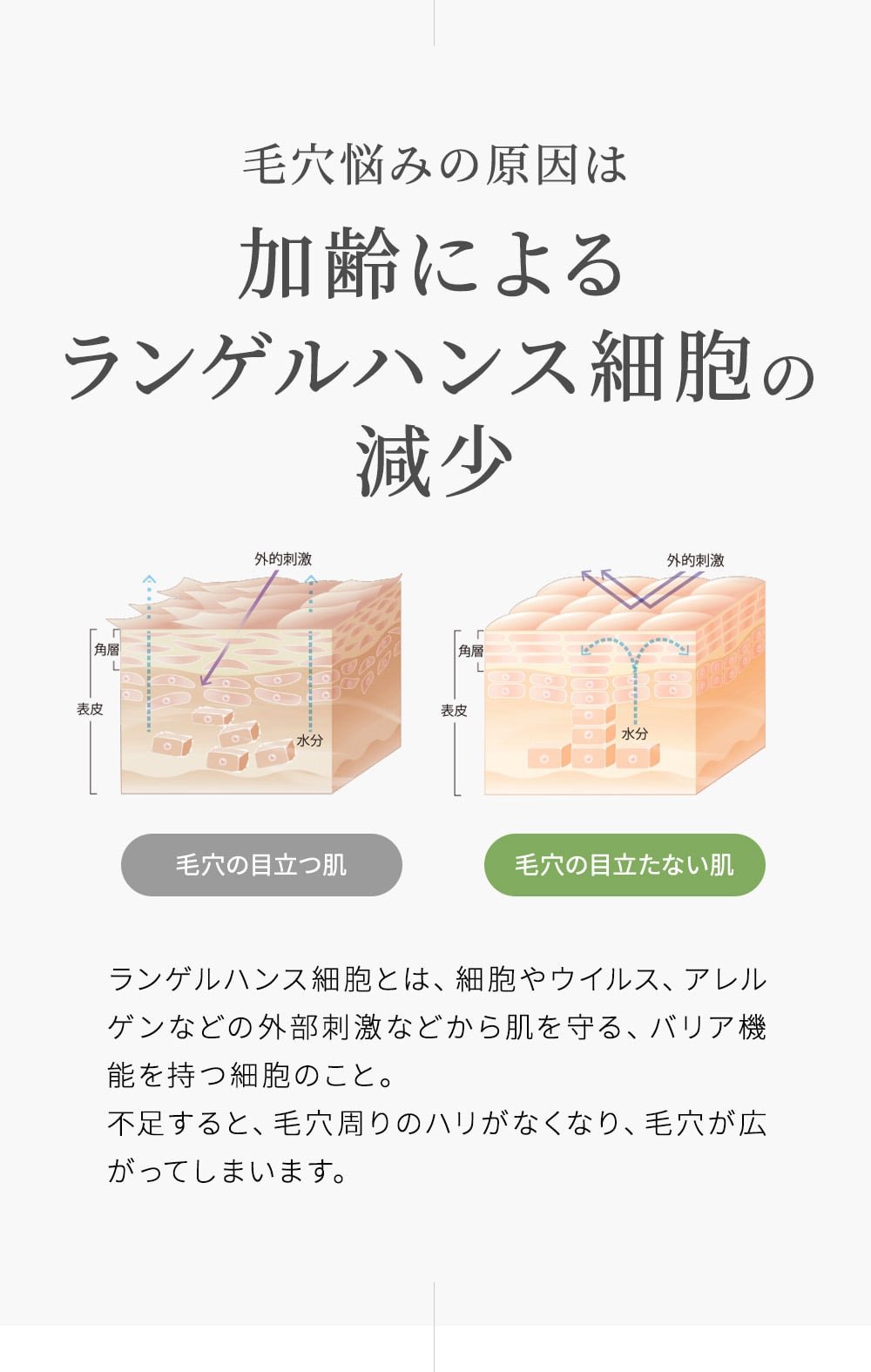 ランゲルハンス細胞